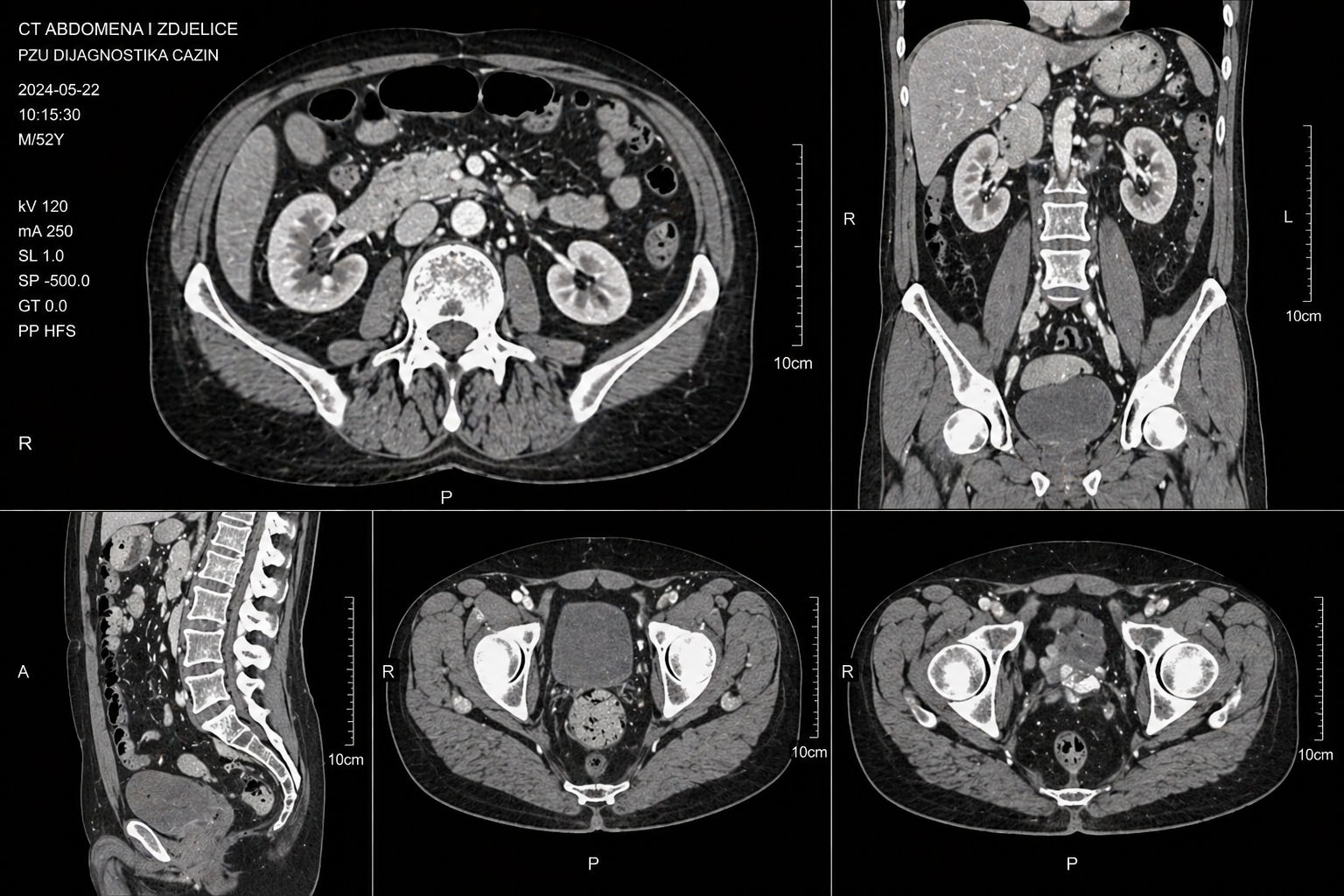 ct-abdomena-zdjelice