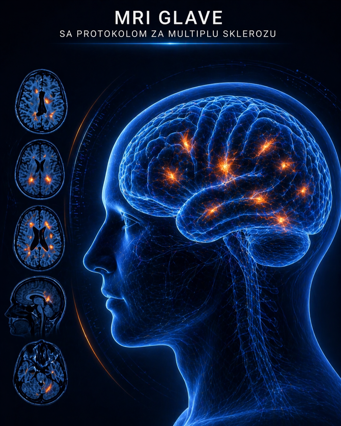 mri-glave-multiplu-sklerozu